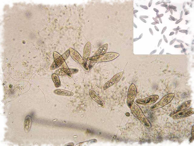 живая пыль под микроскопом